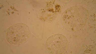Taze su birikintisi su planktonları ve yosun, mikroskop. Vorticella convallaria