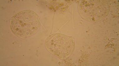 Taze su birikintisi su planktonları ve yosun, mikroskop. Vorticella convallaria