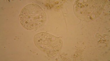 Taze su birikintisi su planktonları ve yosun, mikroskop. Vorticella convallaria
