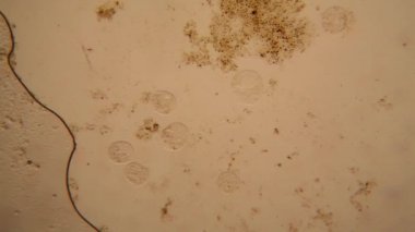 Taze su birikintisi su planktonları ve yosun, mikroskop. Vorticella convallaria
