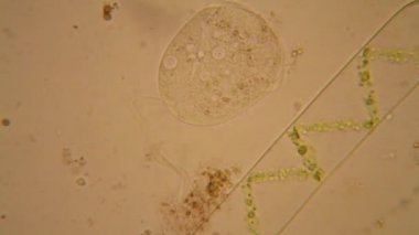 Taze su birikintisi su planktonları ve yosun, mikroskop. Vorticella covallaria ve Spirogyra