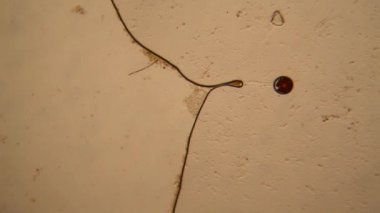 Taze su birikintisi su planktonları ve yosun, mikroskop. Vorticella convallaria ve Nostoc komün