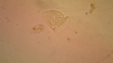 Taze su birikintisi su planktonları ve yosun, mikroskop. Vorticella convallaria