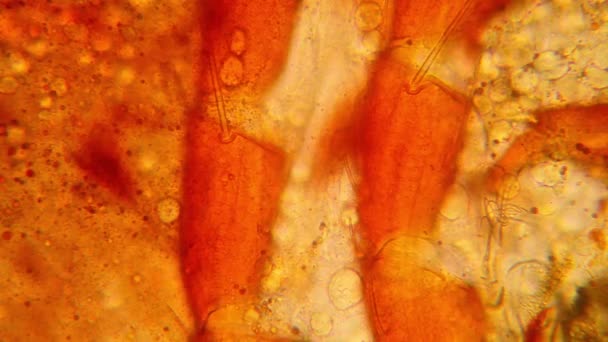 淡水池塘水浮游生物和藻类在显微镜下 池塘螨 身体部分 — 图库视频影像