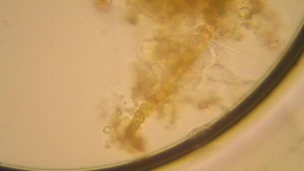 Färsk Damm Vatten Plankton Och Alger Vid Mikroskopet Rotifers — Stockvideo