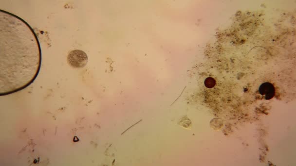 신선한 플랑크톤 그리고 현미경에서 Vorticella Convallaria — 비디오