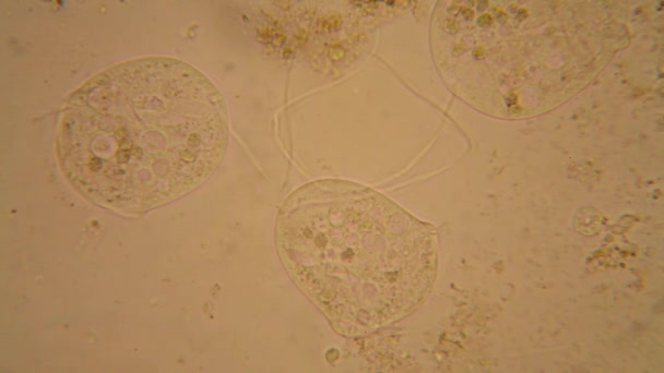 Plancton Agua Dulce Algas Microscopio Vorticella Convallaria — Vídeo de stock