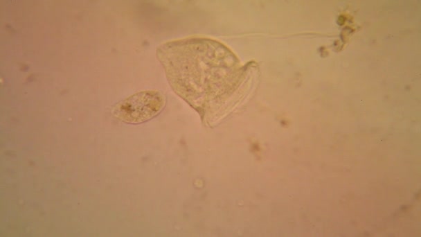 Friss Víz Plankton Alga Mikroszkóp Vorticella Convallaria — Stock videók