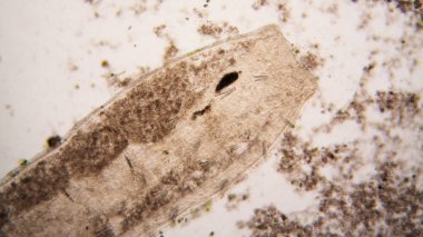 Mikroskobik organizmaların gölet su. Yuvarlak solucanlar - Ayrıntılar