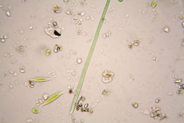 Göl suyu mikroskobik organizmalar. Oscillatoria simplicissima ve Euglena Gracilis