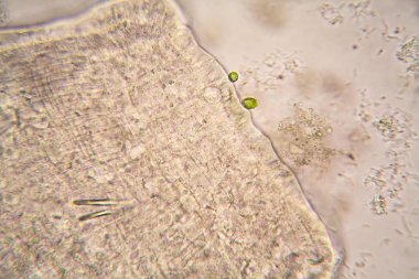 Mikroskobik organizmaların gölet su. Yuvarlak solucanlar - Ayrıntılar