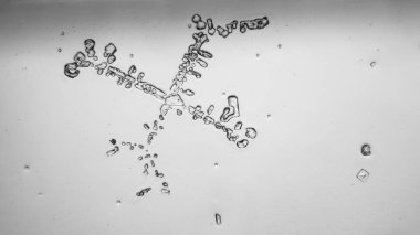 Gözyaşları mikroskop görüş. Büyütme 100-1000 x