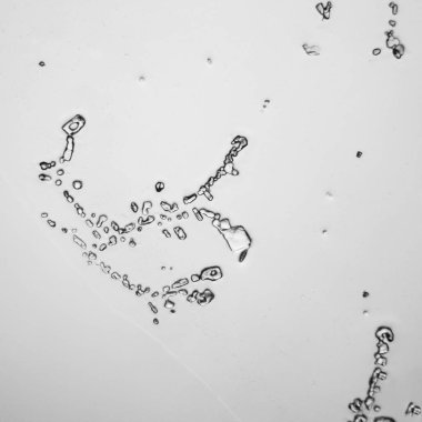 Gözyaşları mikroskop görüş. Büyütme 100-1000 x