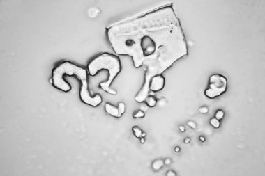 Gözyaşları mikroskop görüş. Büyütme 100-1000 x