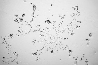 Gözyaşları mikroskop görüş. Büyütme 100-1000 x