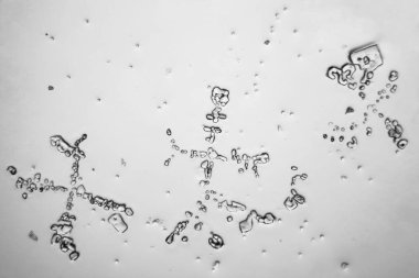 Gözyaşları mikroskop görüş. Büyütme 100-1000 x