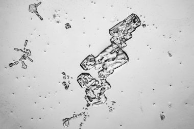 Gözyaşları mikroskop görüş. Büyütme 100-1000 x