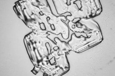 Gözyaşları mikroskop görüş. Büyütme 100-1000 x