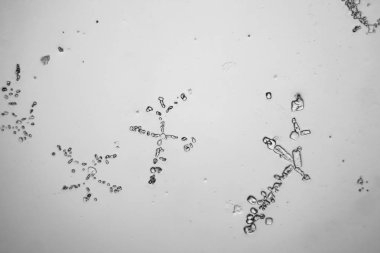 Gözyaşları mikroskop görüş. Büyütme 100-1000 x