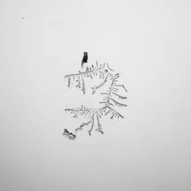 Gözyaşları mikroskop görüş. Büyütme 100-1000 x