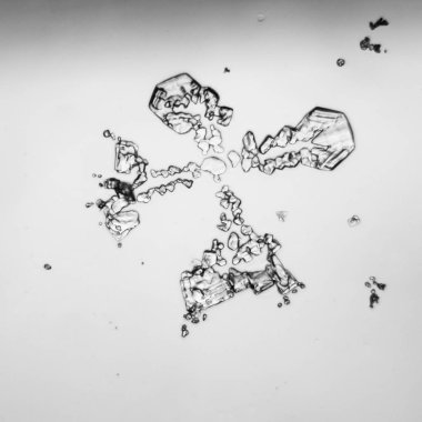 Gözyaşları mikroskop görüş. Büyütme 100-1000 x