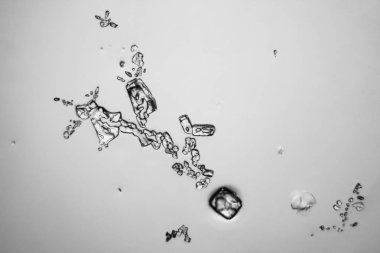 Gözyaşları mikroskop görüş. Büyütme 100-1000 x