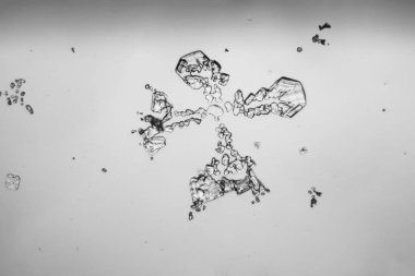 Gözyaşları mikroskop görüş. Büyütme 100-1000 x