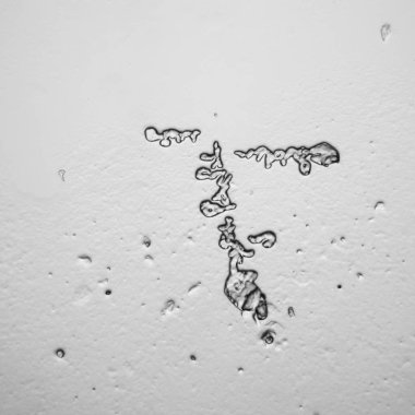 Gözyaşları mikroskop görüş. Büyütme 100-1000 x