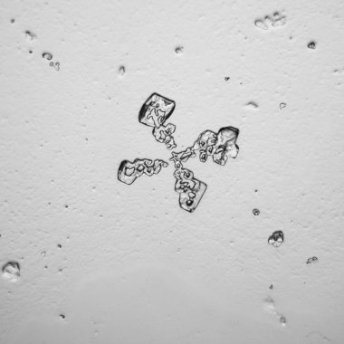 Gözyaşları mikroskop görüş. Büyütme 100-1000 x