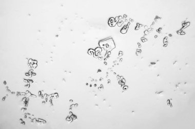 Gözyaşları mikroskop görüş. Büyütme 100-1000 x