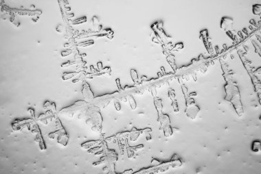 Gözyaşları mikroskop görüş. Büyütme 100-1000 x