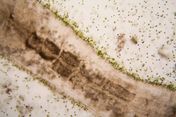 Mikroskobik organizmalar gölün üzerinden. Euglena Gracilis