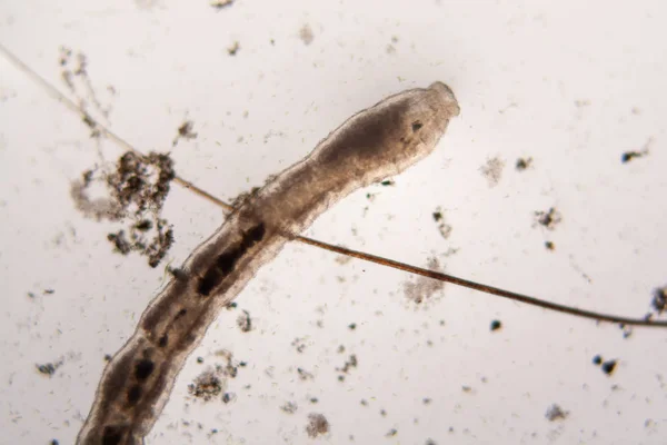 Mikroorganismen Aus Dem Teichwasser Nematode Details — Stockfoto