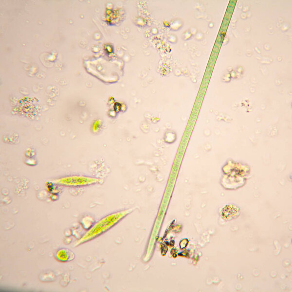 Microscopic organisms in pond water.  Oscillatoria simplicissima and Euglena Gracilis