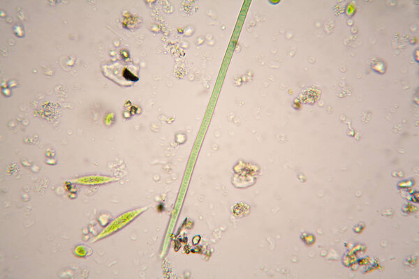 Microscopic organisms in pond water.  Oscillatoria simplicissima and Euglena Gracilis