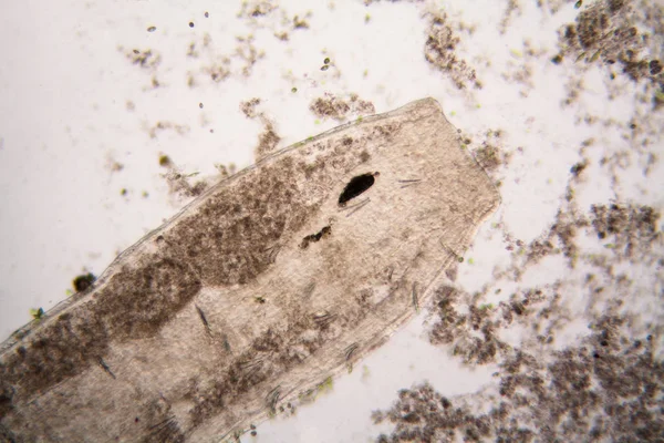 Mikroskobik organizmaların gölet su. Yuvarlak solucanlar - Ayrıntılar