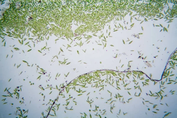 Mikroskobik organizmalar gölün üzerinden. Euglena Gracilis
