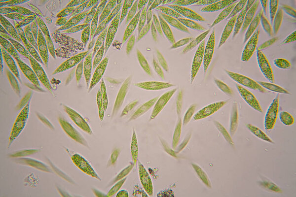 Микроскопические организмы из пруда. Грасилис, Эуглена
