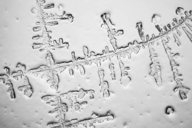 Gözyaşları mikroskop görüş. Büyütme 100-1000 x