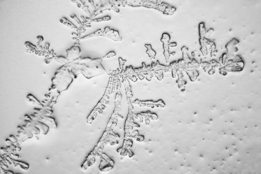 Gözyaşları mikroskop görüş. Büyütme 100-1000 x