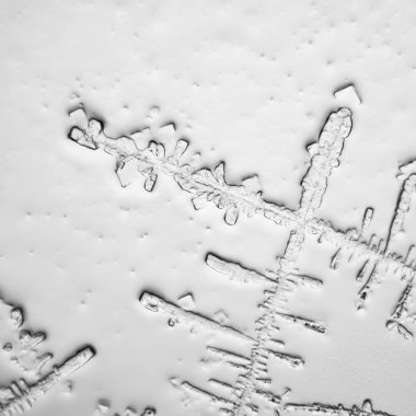 Gözyaşları mikroskop görüş. Büyütme 100-1000 x