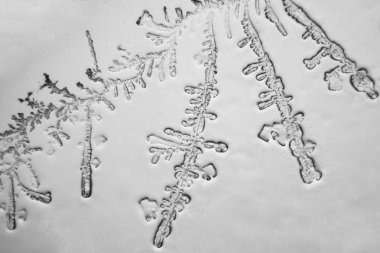 Gözyaşları mikroskop görüş. Büyütme 100-1000 x