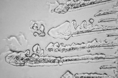 Gözyaşları mikroskop görüş. Büyütme 100-1000 x