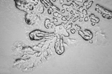 Gözyaşları mikroskop görüş. Büyütme 100-1000 x