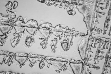 Gözyaşları mikroskop görüş. Büyütme 100-1000 x