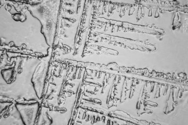 Gözyaşları mikroskop görüş. Büyütme 100-1000 x