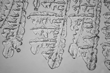 Gözyaşları mikroskop görüş. Büyütme 100-1000 x