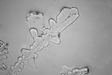 Gözyaşları mikroskop görüş. Büyütme 100-1000 x