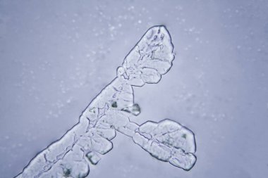 Gözyaşları mikroskop görüş. Büyütme 100-1000 x