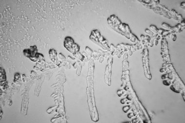 Gözyaşları mikroskop görüş. Büyütme 100-1000 x